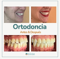 ortodonciaz2.jpg